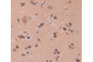 IHC-P analysis of Human Tissue, with DAB staining. (PIN4 抗体  (AA 23-130))