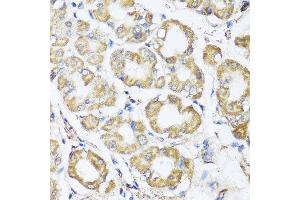 Immunohistochemistry of paraffin-embedded human gastric using B9D1 antibody at dilution of 1:100 (x40 lens). (B9D1 抗体)