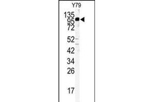 Western blot analysis of KIF3C antibody (C-term) (ABIN391675 and ABIN2841586) in Y79 cell line lysates (35 μg/lane). (KIF3C 抗体  (C-Term))