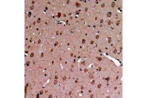 Immunohistochemical analysis of TYRO3/MERTK (pY749/681) staining in human brain formalin fixed paraffin embedded tissue section. (MerTK/Tyro3 抗体  (C-Term, pTyr681, pTyr749))
