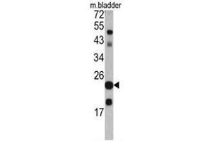 Western blot analysis of TAGLN antibody (C-term) in mouse bladder tissue lysates (35ug/lane). (Transgelin 抗体  (C-Term))