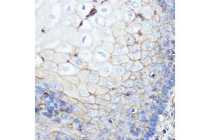 Immunohistochemistry of paraffin-embedded human esophageal using beta 2 Microglobulin Rabbit mAb (ABIN7265876) at dilution of 1:100 (40x lens).