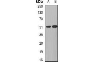 Western blot analysis of MGAT1 expression in human liver (A), human gastric (B) whole cell lysates. (MGAT1 抗体)