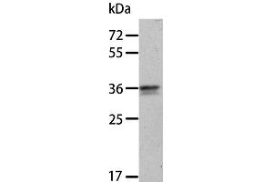 Western Blot analysis of A549 cell using ANXA8 Polyclonal Antibody at dilution of 1:300 (Annexin VIII 抗体)