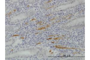 Immunoperoxidase of monoclonal antibody to SMURF1 on formalin-fixed paraffin-embedded human stomach. (SMURF1 抗体  (AA 165-268))