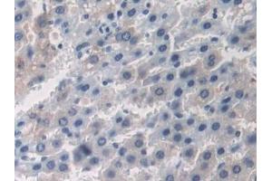 Immunohistochemistry (IHC) image for anti-2',5'-Oligoadenylate Synthetase 1, 40/46kDa (OAS1) (AA 139-358) antibody (ABIN7435082)