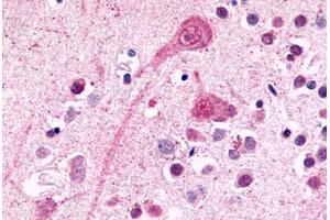Anti-BDKRB2 / BK-2 antibody  ABIN1048349 IHC staining of human brain, neurons and glia. (BDKRB2 抗体  (C-Term))