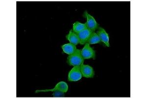 anti-T-Complex 1 (TCP1) (AA 515-551), (C-Term) antibody