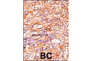 Immunohistochemistry (Paraffin-embedded Sections) (IHC (p)) image for anti-Dual Specificity Phosphatase 10 (DUSP10) (AA 1-30), (N-Term) antibody (ABIN392871)