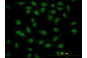 Immunofluorescence of monoclonal antibody to SURB7 on HeLa cell. (MED21 抗体  (AA 1-144))
