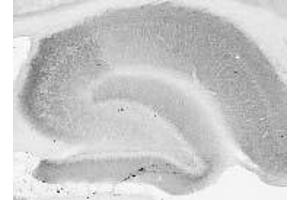 Adult rat brain hippocampus immunohistochemistry. (DLG2 抗体  (AA 1-852))
