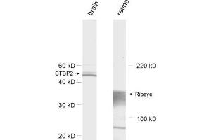 dilution: 1 : 1000, sample: left: rat brain homogenate; right: retina extract (Ribeye (AA 974-988) 抗体)