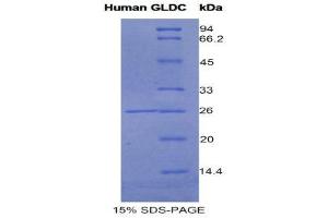 SDS-PAGE (SDS) image for Glycine Dehydrogenase (GLDC) (AA 627-833) protein (His tag) (ABIN1525429) (GLDC Protein (AA 627-833) (His tag))