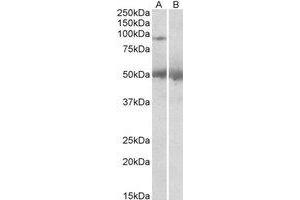 Western Blotting (WB) image for anti-Ubiquitin Specific Peptidase 6 (USP6) (C-Term) antibody (ABIN2466427)