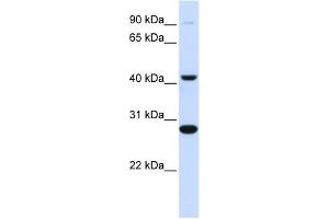 CYB561 antibody used at 1 ug/ml to detect target protein. (CYB561 抗体  (Middle Region))