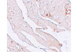 IHC in mouse brain tissue with antibody at 2. (Klotho 抗体  (Center))