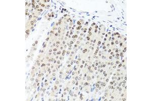 Immunohistochemistry of paraffin-embedded mouse stomach using PARP1 antibody at dilution of 1:100 (x40 lens). (PARP1 抗体)