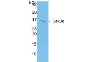 Western blot analysis of recombinant Mouse IRF4. (IRF4 抗体  (AA 175-433))
