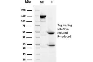 SDS-PAGE Analysis Purified Prohibitin Mouse Monoclonal Antibody (SPM311). (Prohibitin 抗体  (AA 167-261))