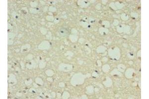 Immunohistochemistry of paraffin-embedded human brain tissue using ABIN7149470 at dilution of 1:100 (DRD5 抗体  (AA 361-477))
