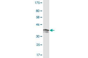 Western Blot detection against Immunogen (37. (PDE5A 抗体  (AA 29-138))