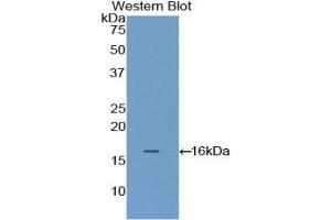 Western blot analysis of the recombinant protein. (FLNB 抗体  (AA 2061-2193))