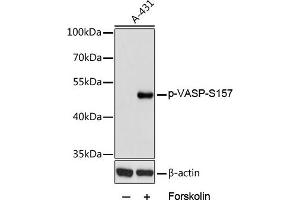 Western blot analysis of extracts of  cells, using Phospho-VASP-S157 antibody (ABIN6135335, ABIN6136286, ABIN6136287 and ABIN6225657) at 1:2000 dilution. (VASP 抗体  (pSer157))