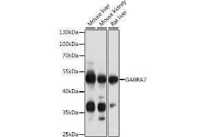 Western blot analysis of extracts of various cell lines, using G antibody (ABIN6134683, ABIN6140901, ABIN6140902 and ABIN6218464) at 1:1000 dilution. (GABRA2 抗体  (AA 300-400))