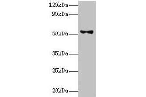 Western blot All lanes: Patatin-like phospholipase domain-containing protein 3 antibody at 8 μg/mL + HepG2 whole cell lysate Secondary Goat polyclonal to rabbit IgG at 1/10000 dilution Predicted band size: 53 kDa Observed band size: 53 kDa (PNPLA3 抗体  (AA 377-481))