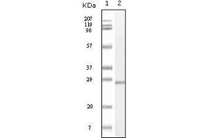 Western blot analysis using S100A mouse mAb against truncated S100A recombinant protein.
