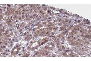 Immunohistochemistry (IHC) image for anti-Solute Carrier Family 16 (Monocarboxylic Acid Transporters), Member 4 (SLC16A4) (Internal Region) antibody (ABIN6266269)