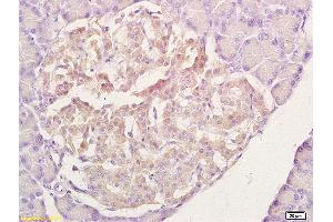 Formalin-fixed and paraffin embedded rat pancreas labeled with Anti-Rad51 Polyclonal Antibody, unconjugated (ABIN673584) at 1:200 followed by incubation with conjugated secondary antibody and DAB staining. (RAD51 抗体  (AA 241-339))