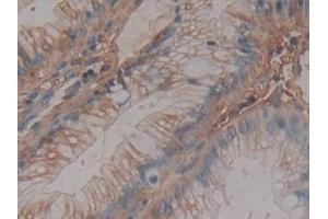 Detection of AT in Human Rectum Tissue using Monoclonal Antibody to Antithrombin (AT) (SERPINC1 抗体)
