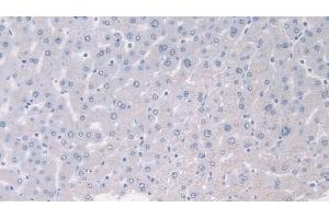 Detection of PANK4 in Human Liver Tissue using Polyclonal Antibody to Pantothenate Kinase 4 (PANK4) (PANK4 抗体  (AA 639-773))