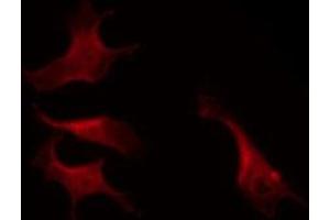 ABIN6269112 staining K562 by IF/ICC. (LYN 抗体  (C-Term))
