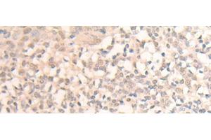 Immunohistochemistry of paraffin-embedded Human tonsil tissue using MLLT6 Polyclonal Antibody at dilution of 1:40(x200) (MLLT6 抗体)