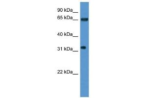 Western Blot showing SRRM4 antibody used at a concentration of 1-2 ug/ml to detect its target protein. (SRRM4 抗体  (Middle Region))