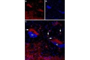 Expression of Muscarinic acetylcholine receptor M4 in mouse islands of Calleja - Immunohistochemical staining of mouse islands of Calleja (ventral striatum) using Anti-CHRM4 Antibody (ABIN7043064, ABIN7044584 and ABIN7044585). (CHRM4 抗体  (AA 330-340))