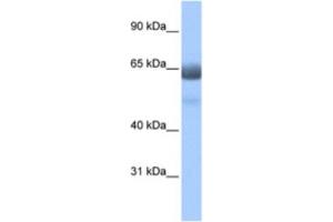 Western Blotting (WB) image for anti-Regulatory Factor X 4 (RFX4) antibody (ABIN2461948)