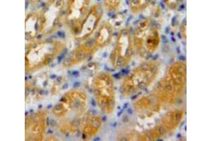 Used in DAB staining on fromalin fixed paraffin-embedded Kidney tissue (LAMC2 抗体  (AA 28-196))