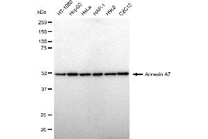 Western blotting analysis using Annexin A7 antibody (ABIN7797625).