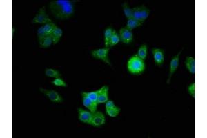 Immunofluorescence staining of HepG2 cells with ABIN7145104 at 1:333, counter-stained with DAPI.
