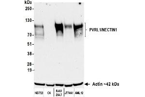 Western Blotting (WB) image for anti-Nectin-1 (NECTIN1) (AA 225-275) antibody (ABIN7795685) (Recombinant Nectin-1 (NECTIN1) (AA 225-275) 抗体)