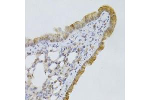 Immunohistochemistry of paraffin-embedded mouse lung using GPD2 Antibody. (GPD2 抗体  (AA 25-325))