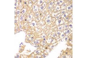 Immunohistochemistry of paraffin-embedded mouse liver using PPP2R2A antibody. (PPP2R2A 抗体)