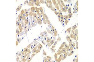 Immunohistochemistry of paraffin-embedded mouse heart using ELF3 antibody at dilution of 1:100 (x40 lens). (ELF3 抗体)