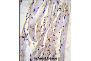 STX19 Antibody immunohistochemistry analysis in formalin fixed and paraffin embedded m. (Syntaxin 19 抗体  (C-Term))