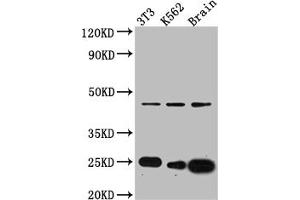 Western Blot Positive WB detected in: NIH/3T3 whole cell lysate, K562 whole cell lysate, Mouse Brain whole cell lysate All lanes: CDC42 antibody at 1:1000 Secondary Goat polyclonal to rabbit IgG at 1/50000 dilution Predicted band size: 22, 22 kDa Observed band size: 24 kDa (Recombinant CDC42 抗体)