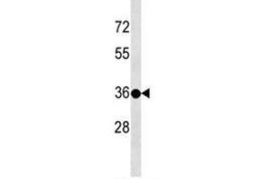 TSPY3 antibody western blot analysis in 293 lysate. (TSPY3 抗体  (AA 277-305))