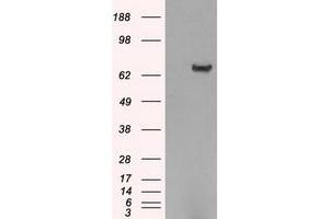 Image no. 2 for anti-Histone Deacetylase 10 (HDAC10) antibody (ABIN1498609) (HDAC10 抗体)